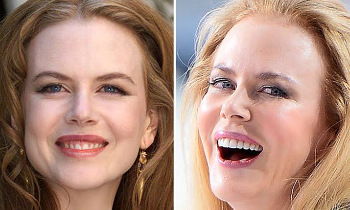 ungeschminkt nicole kidman